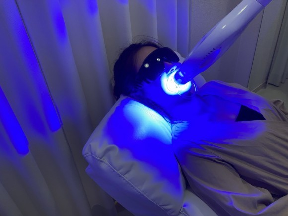 寝ながらホワイトニングするだけで歯が白く