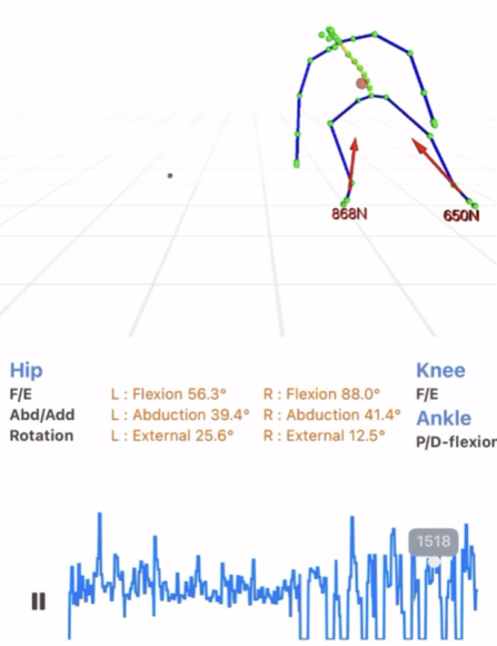 TNQ Tech、iPhoneでの3Dモーション解析・床反力推定技術をリリース