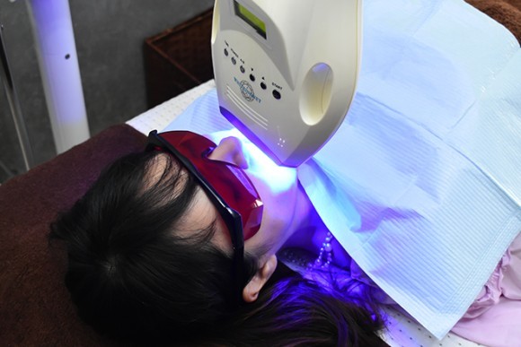 セルフホワイトニング　池袋