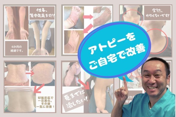 人手不足問題を解決のため 企業に向け福利厚生の提供を開始します